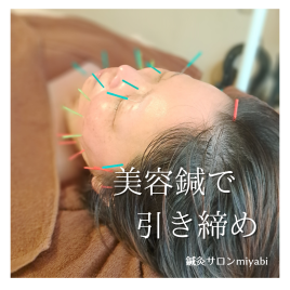 鍼灸サロンmiyabi 背中から引き上げる☆プレミアム美容鍼のメニュー画像