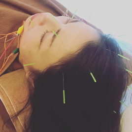 鍼灸＆ボディケアサロン大濠ベッラ たるみに特化した美容鍼のメニュー画像