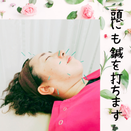 なごみ堂鍼灸・整骨院 美容鍼のメニュー画像