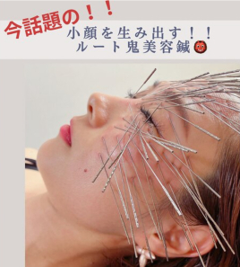 美鍼灸salon L'ins soi ルート鬼美容鍼のメニュー画像