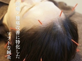 宇多津　【頭痛・腰痛専門】　鍼灸院　SHIMADA ◆新規限定◆ 【頭痛・腰痛】専門鍼灸のメニュー画像