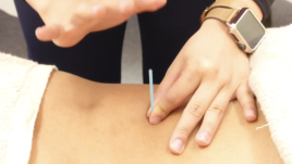 岡鍼灸接骨院 鍼治療のメニュー画像