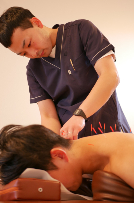 行田ウィル鍼灸整骨院 鍼灸治療のメニュー画像