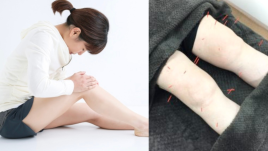 宇多津【頭痛・腰痛専門】鍼灸院 SHIMADA 「痛みと不調に特化した鍼灸院」〜 【膝】専門の鍼灸治療のメニュー画像