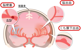 宇多津【頭痛・腰痛専門】鍼灸院 SHIMADA 「痛みと不調に特化した鍼灸院」〜 脳卒中・後遺症の鍼灸治療「醒脳開竅法」〜のメニュー画像