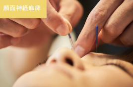 宇多津【頭痛・腰痛専門】鍼灸院 SHIMADA 「痛みと不調に特化した鍼灸院」〜 顔面神経麻痺の鍼灸のメニュー画像