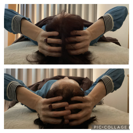 murir鍼灸院 頭皮鍼＋ドライヘッドスパのメニュー画像