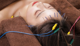 せせらぎ鍼灸整骨院九条院 頭皮鍼のメニュー画像