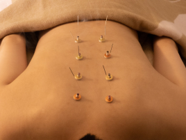 美容鍼灸サロンamo 【より深いお悩みに】relax鍼灸のメニュー画像