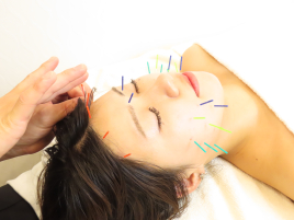 美容鍼灸サロン　HARILANCE 美容鍼×表情筋フェイシャルPROのメニュー画像