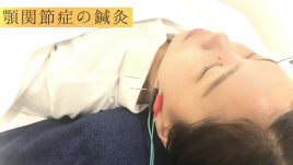 宇多津【頭痛・腰痛専門】鍼灸院 SHIMADA 「痛みと不調に特化した鍼灸院」〜 【顎関節症】専門鍼灸治療のメニュー画像