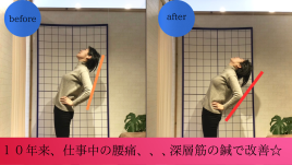 宇多津【頭痛・腰痛専門】鍼灸院　SHIMADA 「痛みと不調に特化した鍼灸院」〜 【腰痛専門鍼灸治療】のメニュー画像