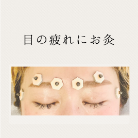 CORAL_acu女性専門鍼灸サロン 鍼灸治療オプションメニュー:眼精疲労お灸のメニュー画像