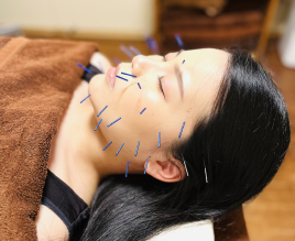 CORAL_acu女性専門鍼灸サロン 美容はり　艶はりコースのメニュー画像
