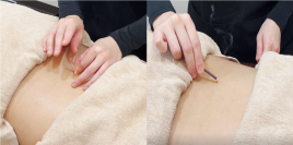 三郷駅前はりきゅう整骨院 はり・きゅうのメニュー画像