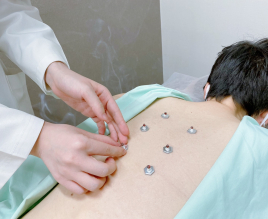 漢方薬・鍼灸 世珍堂 ”痛み”をとる鍼灸(整形外科疾患)のメニュー画像
