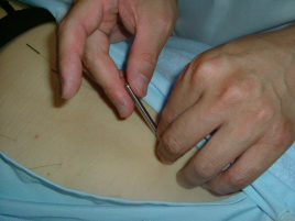 気楽治療院 鍼灸B（ライト、６０分枠）のメニュー画像