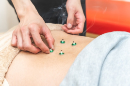 むさし鍼灸整骨院　日田院 鍼灸整体のメニュー画像