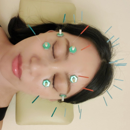 はり灸心音 眼精疲労・首肩こりに！上半身集中鍼灸のメニュー画像
