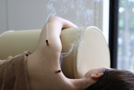 M's鍼灸院 鍼灸のメニュー画像