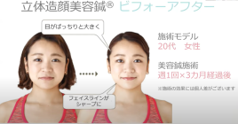 鍼灸整体　LightHouse 美容鍼（プラスライン）（JMCAA認定）のメニュー画像