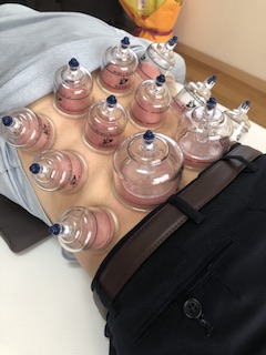 岡山鍼灸院 オーダーメイド治療お試しのメニュー画像