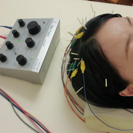 はり灸心音 髪の悩みに集中ケア【電気を流す頭鍼灸】のメニュー画像