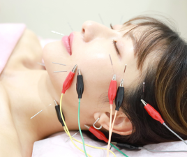 美容鍼灸サロン　Sachi-幸- 【ご新規様限定】電気を流す美容鍼のメニュー画像