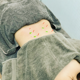 ｊｏｙｐｌｕｓ．南草津鍼灸整骨院 鍼灸全身調整治療のメニュー画像