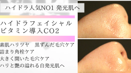 さつき鍼灸整骨院 ハイドラフェイシャルビタミン導入CO2のメニュー画像