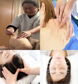 やわらげ鍼灸room 鍼灸施術60分+美容鍼のメニュー画像