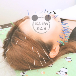 ぱんだのあんま 美容鍼【100本】8300円のメニュー画像
