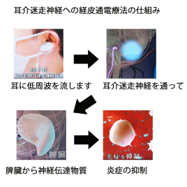 和泉府中オステオパシーセンター 耳介迷走神経通電療法+整体のメニュー画像
