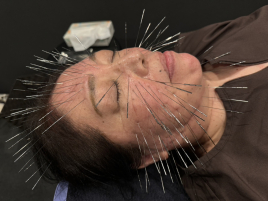 女性専門えびす鍼灸整骨院　〜女性の為のルート鍼治療〜 ルート鍼治療＋空ルート＝60分のメニュー画像