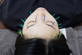 はま鍼灸整骨院　八鹿本院 美容鍼灸のメニュー画像