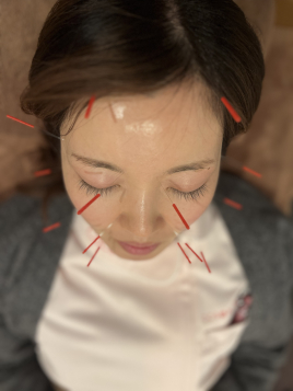 こころ接骨鍼灸マッサージ院　浅間通り院 季節限定　花粉症コースのメニュー画像