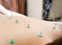 かきざわ鍼灸指圧マッサージ院 メンテンナンス鍼灸６０のメニュー画像