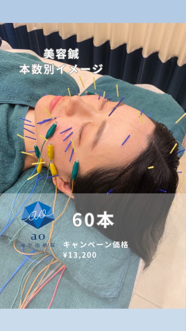 aoはり治療院 栄院 【 美容鍼 】60本のメニュー画像