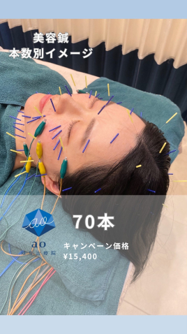 aoはり治療院 栄院 【 美容鍼 】70本のメニュー画像