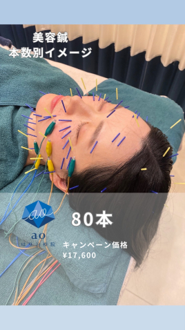 aoはり治療院 栄院 【 美容鍼 】80本のメニュー画像