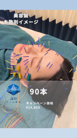 aoはり治療院 栄院 【 美容鍼 】90本のメニュー画像