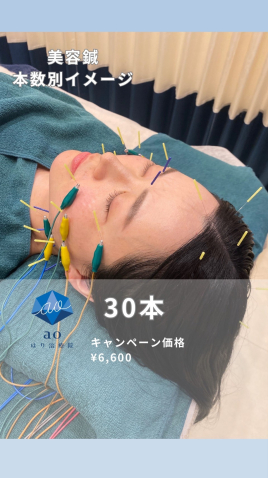 aoはり治療院 金山院 ＜美容鍼＞ 30本のメニュー画像