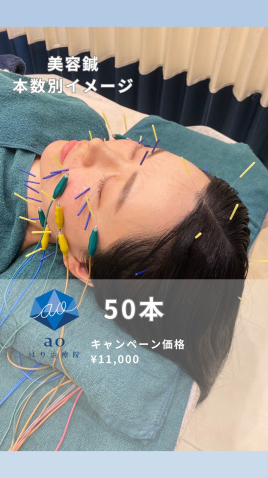 aoはり治療院 金山院 ＜美容鍼＞ 50本のメニュー画像