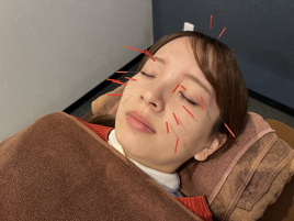 こころ接骨鍼灸マッサージ院　沓谷本院 花粉症コースのメニュー画像