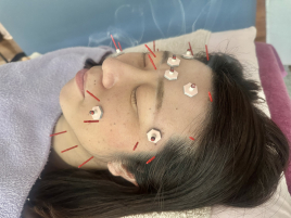 愛三堂鍼灸院plus からだとかおの　はりきゅうのメニュー画像