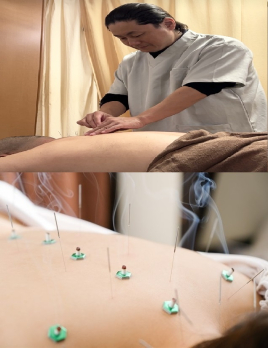 やわらげ鍼灸room クイック鍼灸施術のメニュー画像