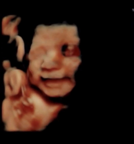 ほしやま鍼灸院 マタニティケアのメニュー画像