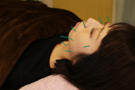 ほしやま鍼灸院 美容鍼灸のメニュー画像