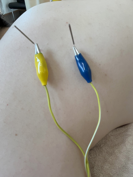 鍼灸整骨カラダステーション 痛み・シビレ・コリのメニュー画像