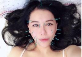 美容鍼灸TAKAHINA横浜 韓国式美容鍼のメニュー画像